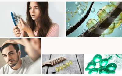 5 Razones que Ocasionan la Pérdida de Cabello Femenina.