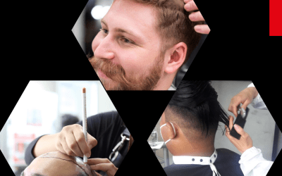 Prótesis Capilares un Solución Eficaz para la Pérdida de Cabello.