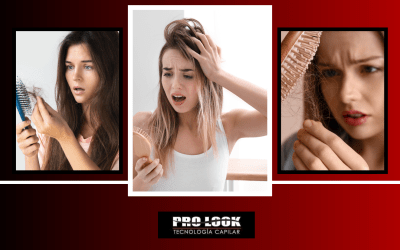 Medidas Preventivas para la Alopecia Femenina.