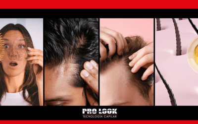 COVID-19 y la Pérdida de Cabello.