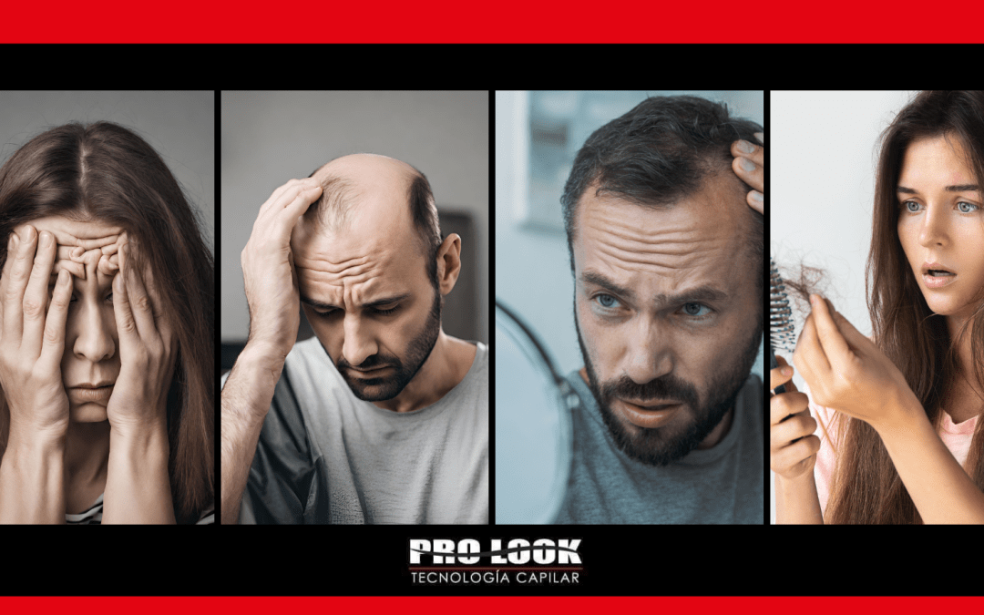 Causas de la caída del cabello durante el encierro en la Pandemia.