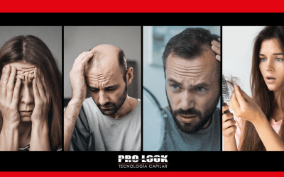 Causas de la caída del cabello durante el encierro en la Pandemia.